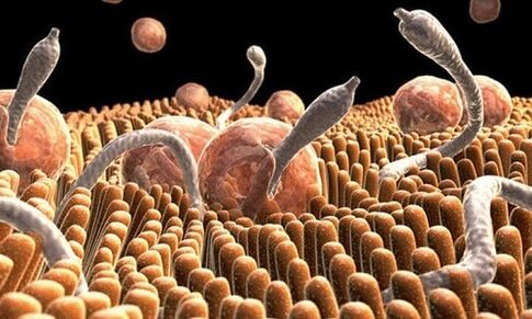hoe wormen eruit zien in het menselijk lichaam