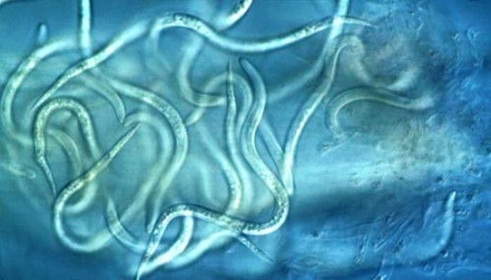 hoe zien nematodenparasieten eruit in het menselijk lichaam