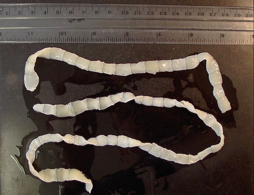 brede lintworm in het menselijk lichaam