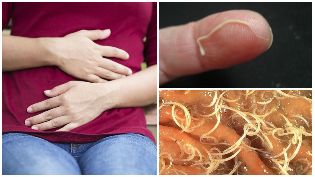 wormen in het menselijk lichaam